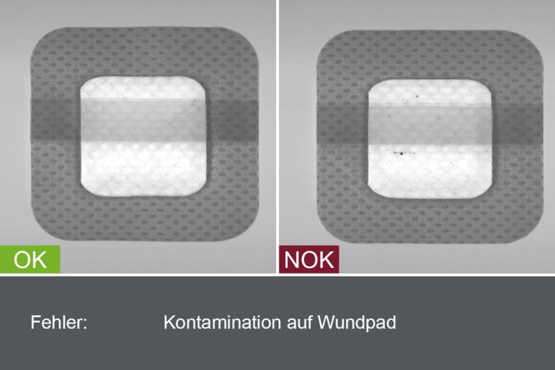 Industrielles Kamerabild von der Inspektion von Pflastern im Produktionsprozess - Kontamination auf Wundpad - mit Gut- und Schlechtbild