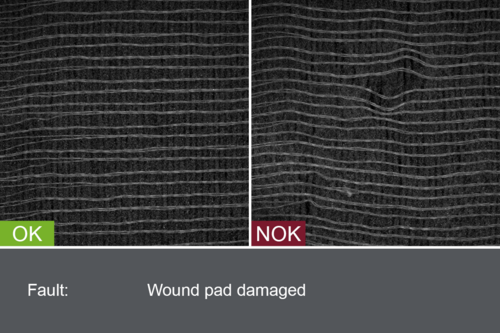 Inspection of wound dressings for patches