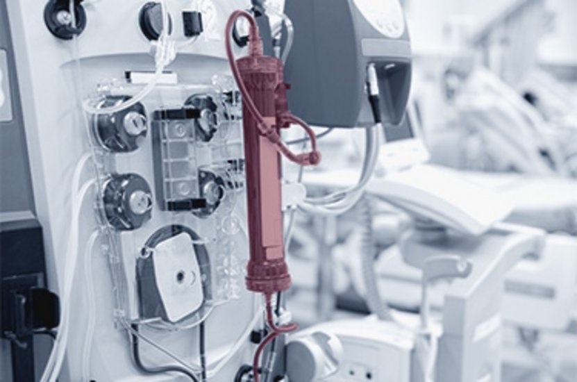 ein roter Dialysefilter ist in einer Dialyse-Gerät im Krankenhaus verbaut 