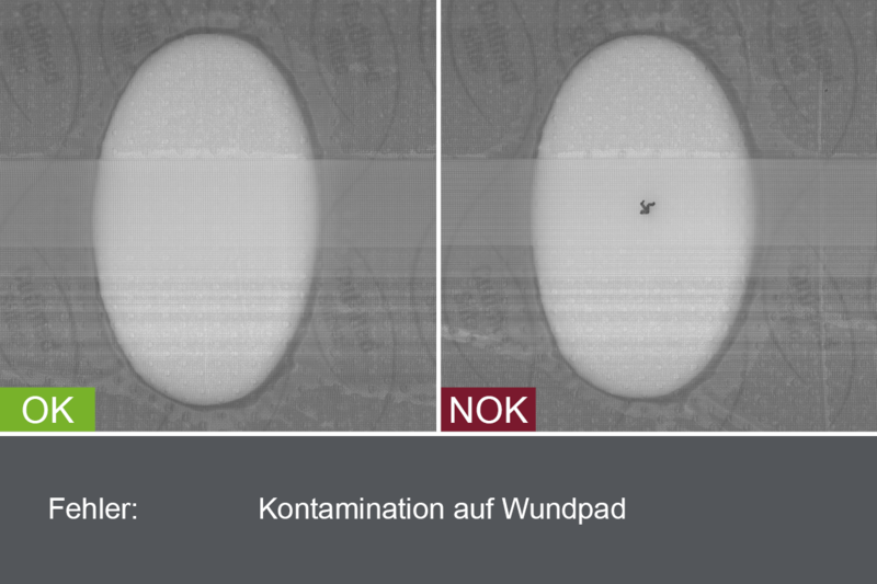 Industrielles Kamerabild von der Inspektion von Pflastern im Produktionsprozess - Kontamination auf Wundpad - mit Gut- und Schlechtbild